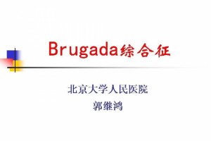 Brugada综合症